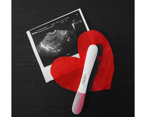 国内试管助孕代生,什么人适合做第三代试管婴儿？