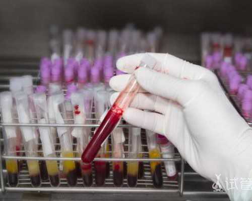 国内代生中心价格,印度尼西亚试管婴儿医*有哪些 如何选择