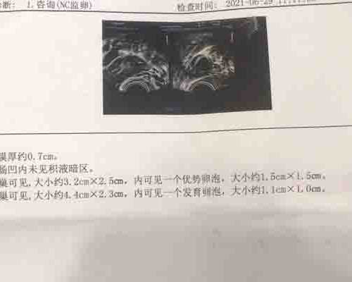 国内供卵试管合同,日本试管婴儿水平处于领先地位 *率高与这些因素有关