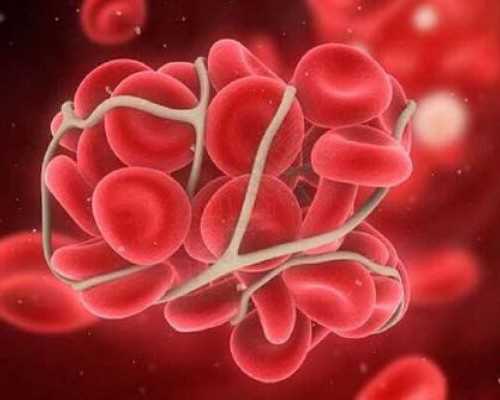 国内哪里代怀,宫颈刮片前的注意事项要做好，拒绝同房结果会更准确						