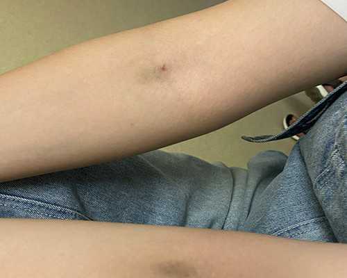 国内试管供卵医院排名,同性恋做试管婴儿需要多少钱，附费用明细！